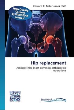portada Hip replacement (en Inglés)