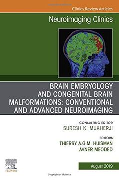 portada Brain Embryology and the Cause of Congenital Malformations, an Issue of Neuroimaging Clinics of North America, 1e (The Clinics: Radiology) (in English)