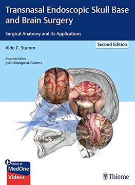 portada Transnasal Endoscopic Skull Base and Brain Surgery: Surgical Anatomy and Its Applications (in English)