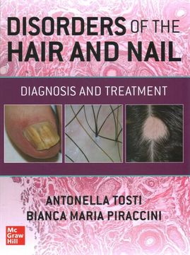 portada Disorders of the Hair and Nail: Diagnosis and Treatment (in English)