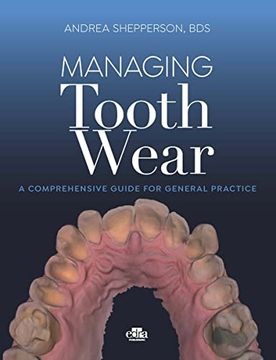 portada Managing Tooth Wear. A Comprehensive Guide for General Practice (in English)