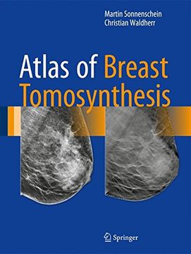 portada Atlas of Breast Tomosynthesis: Imaging Findings and Image-Guided Interventions (en Inglés)