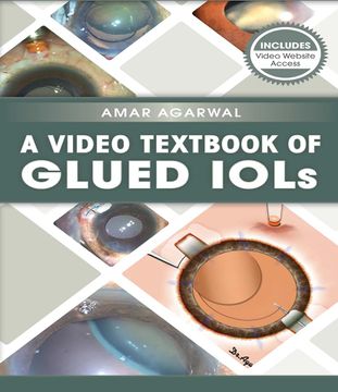 portada A Video Textbook of Glued Iols (en Inglés)