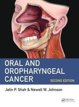 portada Oral and Oropharyngeal Cancer