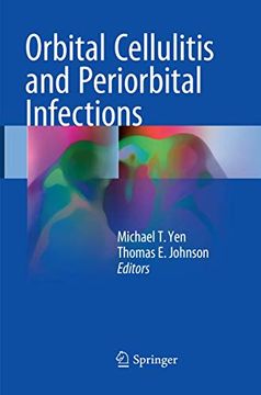 portada Orbital Cellulitis and Periorbital Infections (en Inglés)