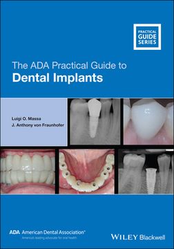 portada The ADA Practical Guide to Dental Implants (en Inglés)
