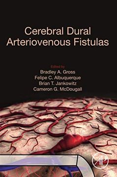 portada Cerebral Dural Arteriovenous Fistulas (en Inglés)