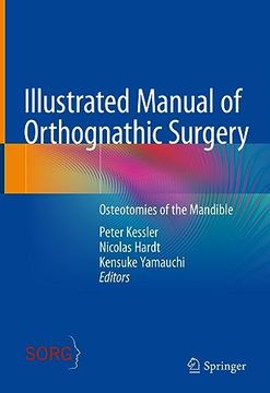 portada Illustrated Manual of Orthognathic Surgery: Osteotomies of the Mandible (in English)