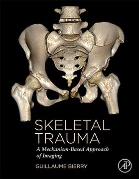 portada Skeletal Trauma: A Mechanism-Based Approach of Imaging (en Inglés)