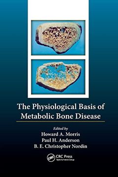 portada The Physiological Basis of Metabolic Bone Disease (in English)