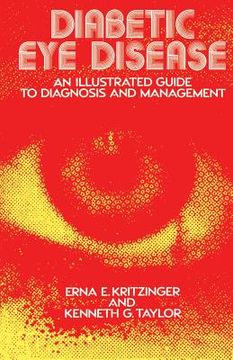portada Diabetic Eye Disease: An Illustrated Guide to Diagnosis and Management (en Inglés)