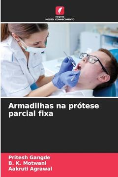 portada Armadilhas na Prótese Parcial Fixa (en Portugués)