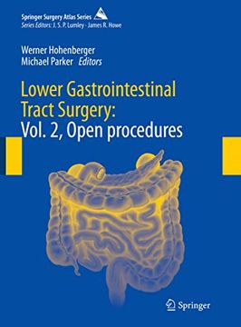 portada Lower Gastrointestinal Tract Surgery: Vol. 2, Open Procedures (en Inglés)
