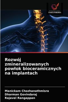 portada Rozwój zmineralizowanych powlok bioceramicznych na implantach (in Polaco)
