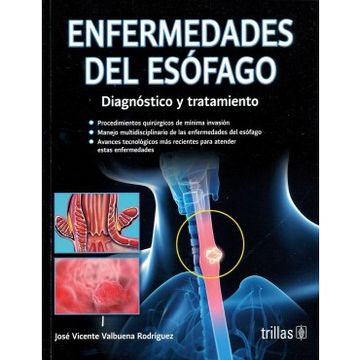 portada Enfermedades del Esofago: Diagnostico y Tratamiento