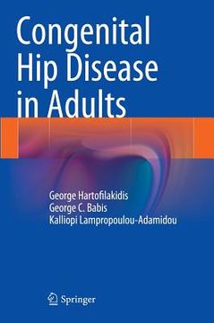portada Congenital Hip Disease in Adults (en Inglés)