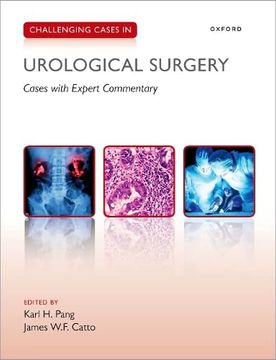 portada Challenging Cases in Urological Surgery (en Inglés)