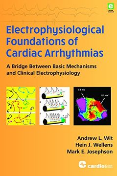 portada Electrophysiological Foundations of Cardiac Arrhythmias: A Bridge Between Basic Mechanisms and Clinical Electrophysiology
