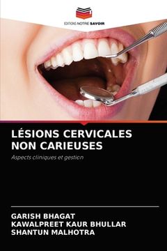 portada Lésions Cervicales Non Carieuses (en Francés)
