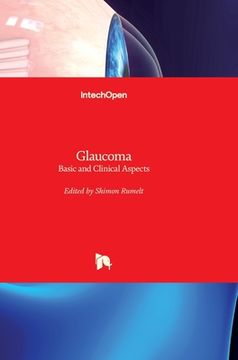 portada Glaucoma: Basic and Clinical Aspects