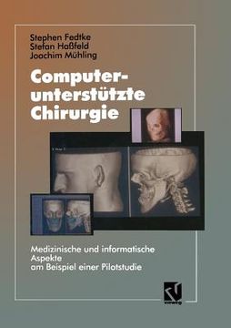 portada Computerunterstã¼Tzte Chirurgie de Fedtke(Springer Verlag Gmbh) (en Alemán)