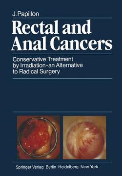 portada rectal and anal cancers: conservative treatment by irradiation an alternative to radical surgery (in English)