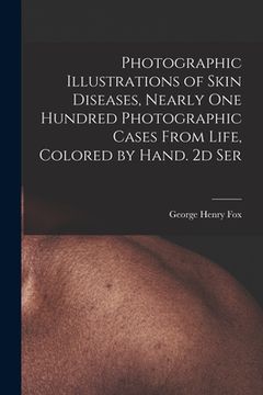 portada Photographic Illustrations of Skin Diseases, Nearly One Hundred Photographic Cases From Life, Colored by Hand. 2d Ser (en Inglés)