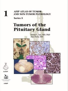 portada Tumors of the Pituitary Gland (Afip Atlas of Tumor and Non-Tumor Pathology, Series 5) (en Inglés)