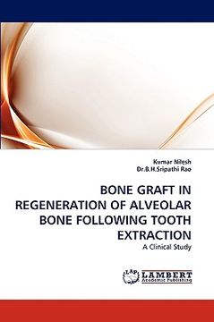 portada bone graft in regeneration of alveolar bone following tooth extraction (en Inglés)