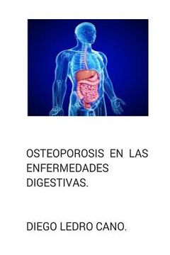 portada Osteoporosis en las enfermedades digestivas.