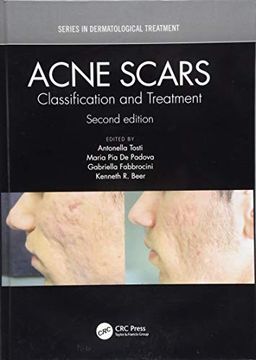 portada Acne Scars: Classification and Treatment, Second Edition (in English)