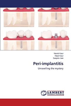 portada Peri-implantitis
