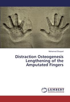 portada Distraction Osteogenesis Lengthening of the Amputated Fingers