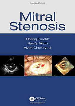 portada Mitral Stenosis (in English)