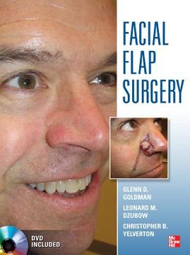 portada Facial Flaps Surgery (en Inglés)
