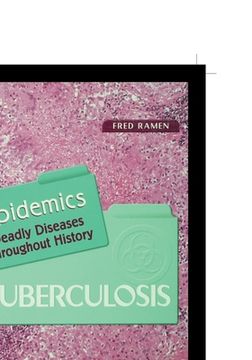 portada Tuberculosis (en Inglés)