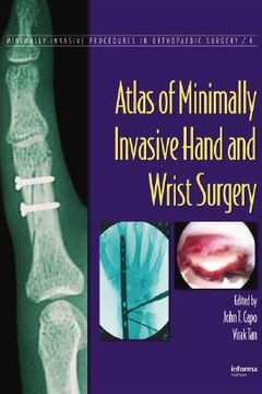 portada atlas of minimally invasive hand and wrist surgery (in English)