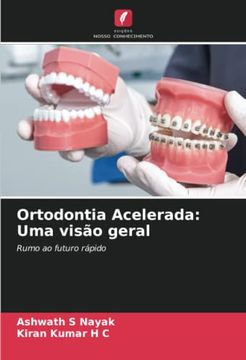 portada Ortodontia Acelerada: Uma Visão Geral