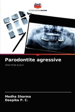 portada Parodontite agressive (en Francés)