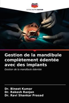 portada Gestion de la mandibule complètement édentée avec des implants (en Francés)