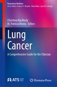 portada Lung Cancer: A Comprehensive Guide for the Clinician (en Inglés)
