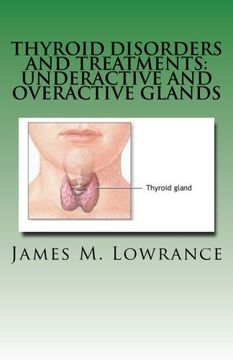 portada Thyroid Disorders and Treatments: Underactive and Overactive Glands: Understanding Hypothyroid and Hyperthyroid Conditions (en Inglés)