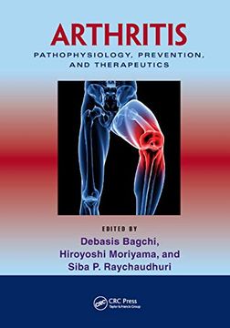portada Arthritis: Pathophysiology, Prevention, and Therapeutics (en Inglés)