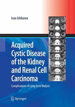 portada Acquired Cystic Disease of the Kidney and Renal Cell Carcinoma: Complication of Long-Term Dialysis (en Inglés)