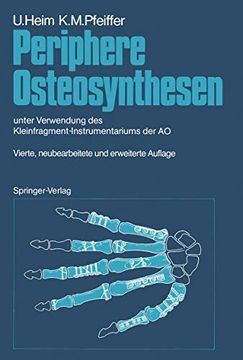 portada Periphere Osteosynthesen: Unter Verwendung des Kleinfragment-Instrumentariums der ao (en Alemán)