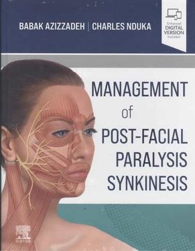 portada Management of Post-Facial Paralysis Synkinesis 