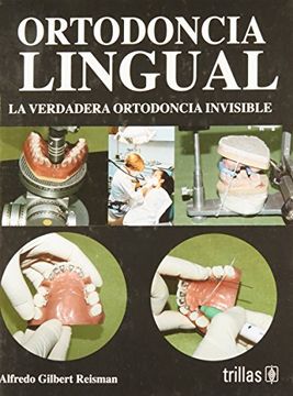 portada Ortodoncia Lingual: La Verdadera Ortodoncia Invisible (in Spanish)