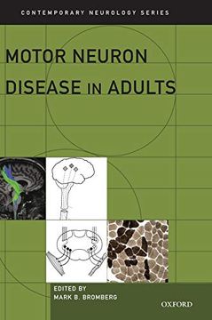 portada Motor Neuron Disease in Adults (Contemporary Neurology Series) (in English)