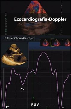 portada Ecocardiografía-Doppler: 114 (Educació. Sèrie Materials) (in Spanish)