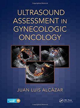 portada Ultrasound Assessment in Gynecologic Oncology (en Inglés)